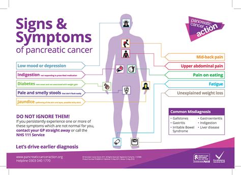 king charles pancreatic cancer symptoms